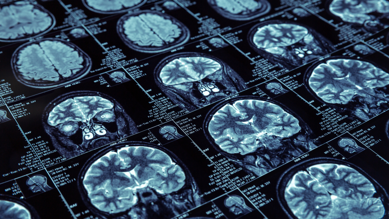 header image featuring a collection of brain scans